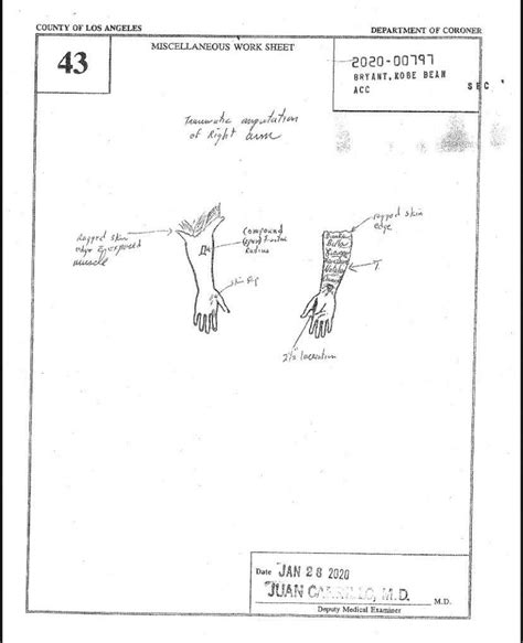 gigi.bryant autopsy|File : Gianna Bryants autopsy report (2020).pdf